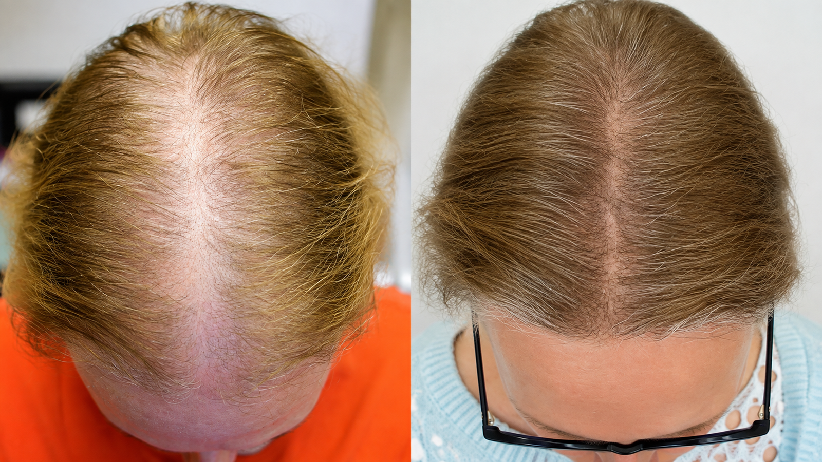 Customer hair transformation result 9
